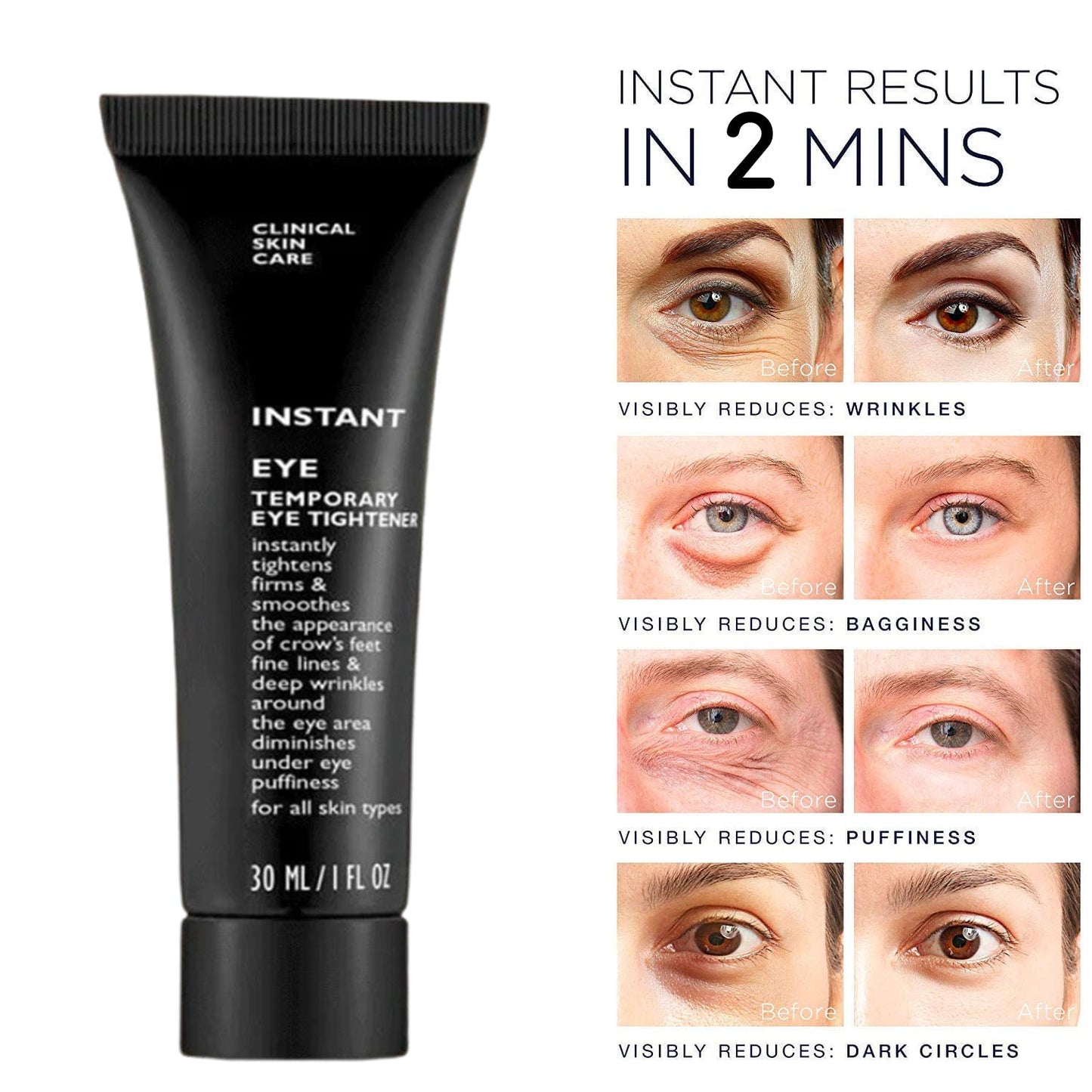 Instant Wrinkle Eye Tightener cream.